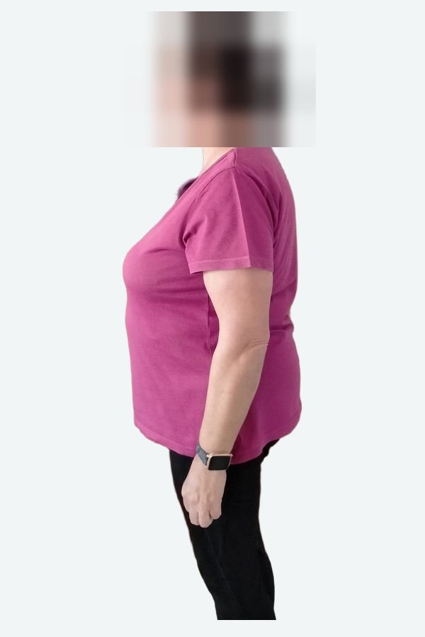 Beatriz antes, de lado, con la cara pixelada
